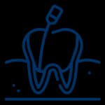 Root Canal Treatment